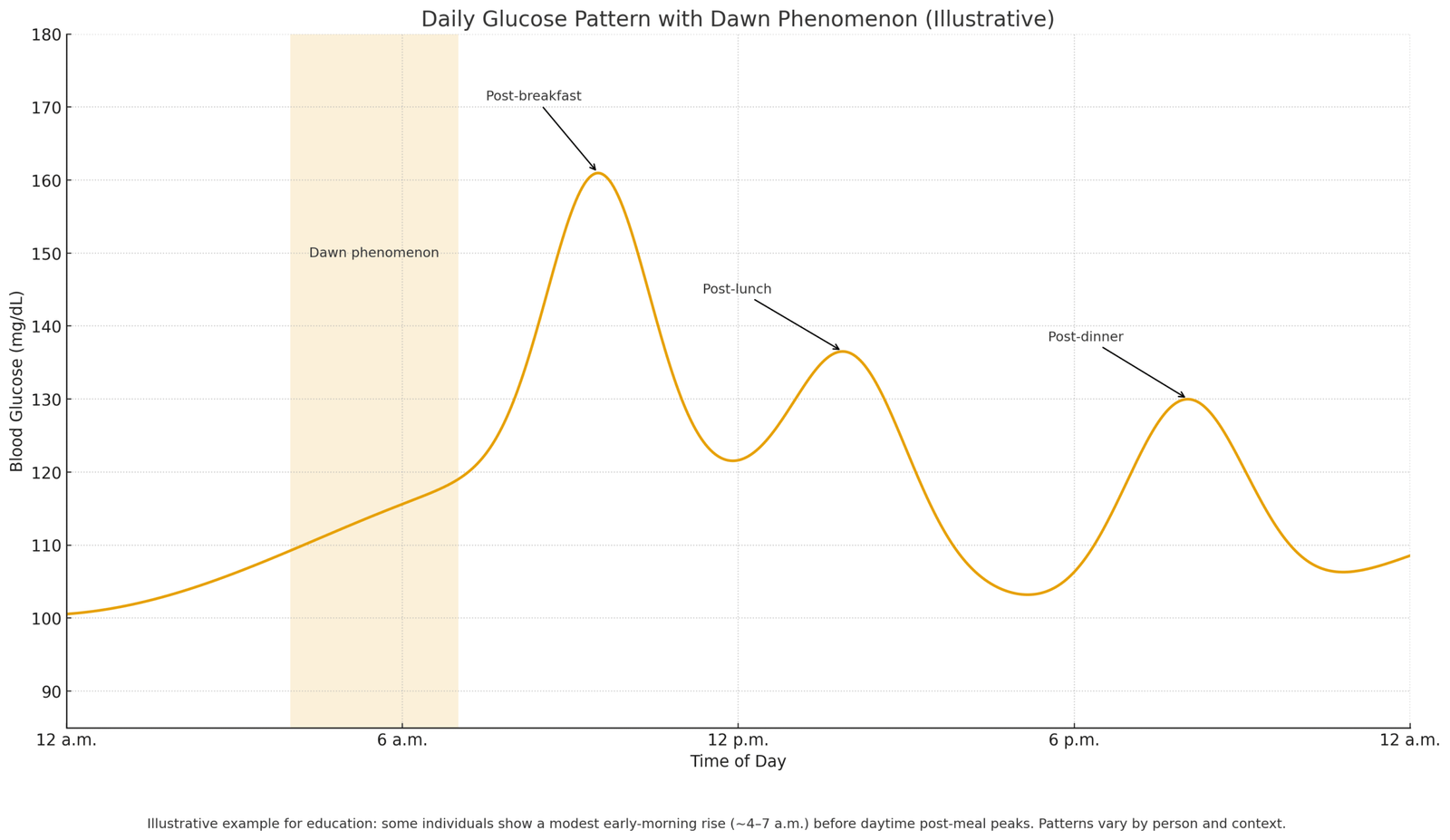 Early-morning rise (dawn phenomenon) affecting fasting insulin and glucose.