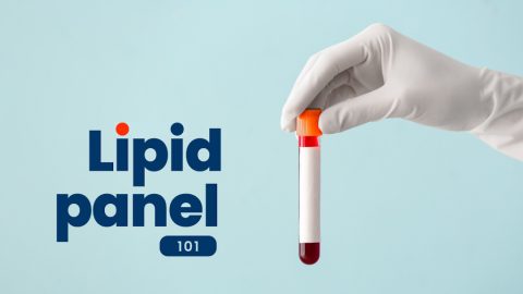 Lipid Panel with Reflex to Direct LDL Explained