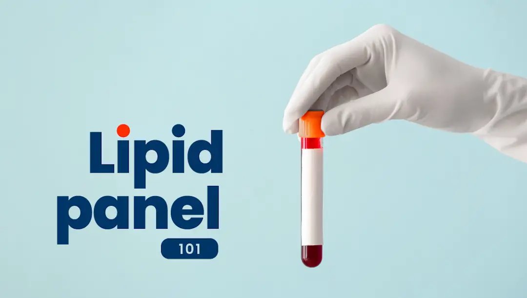 Lipid Panel with Reflex to Direct LDL