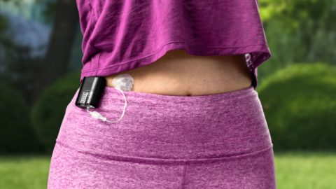 Mobi Insulin Pump Review: Benefits, Costs, and Real-World Use