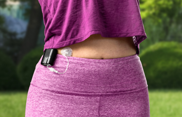 Mobi Insulin Pump